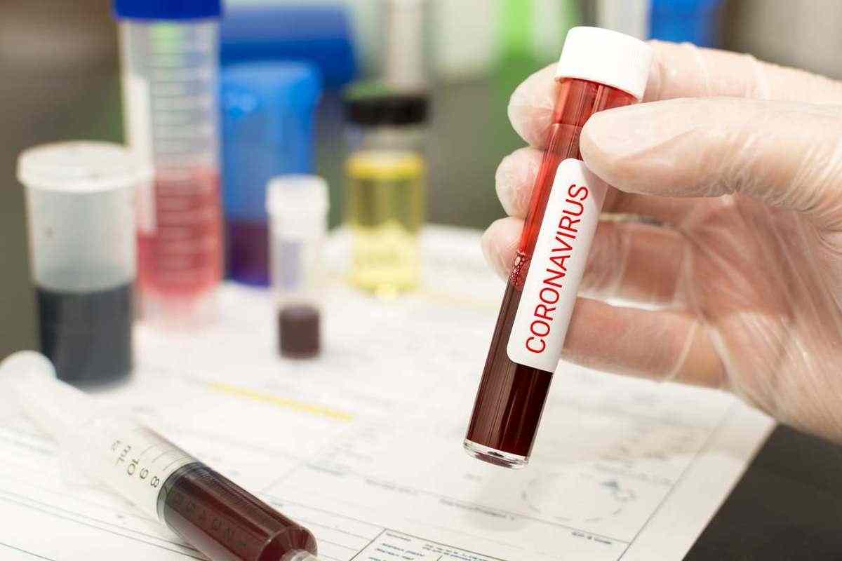 Los casos de coronavirus en EE. UU. aumentan en 47 000, es el mayor pico de pandemia en un día